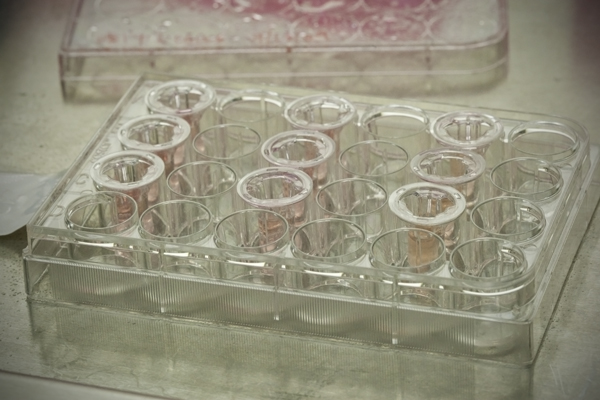 Water-retaining hydrogels – the unsung heroes of medicine